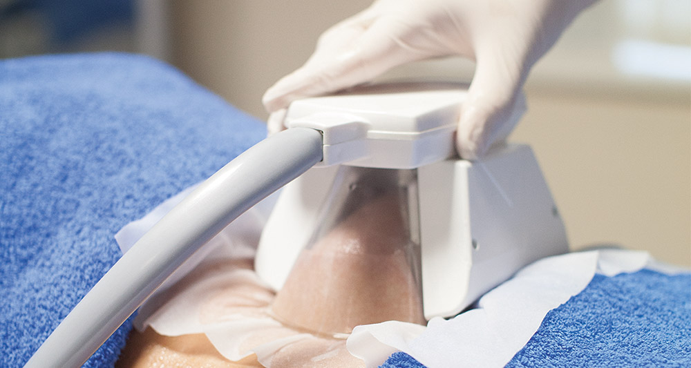 How Fat Freezing and HIFU Work Together? 2 Multiple Areas in One Session HIFU and Fat Freezing Hayes