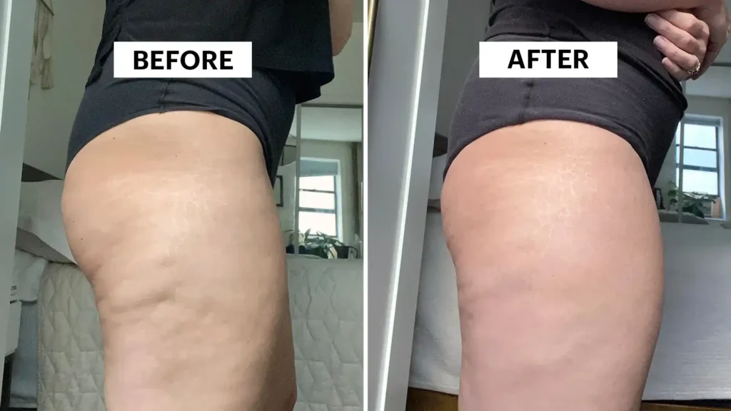 Sculpting Your Bum: Can Toning Exercises Really Reduce Cellulite? 1 Do Toning Exercise Hayes Really Tackle Cellulite?